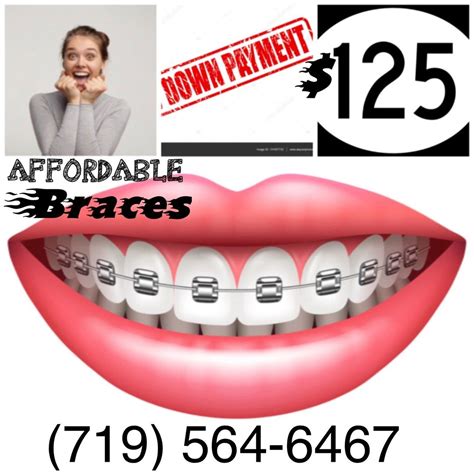 cheapest braces